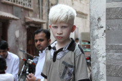 International Albinism Awareness Day 