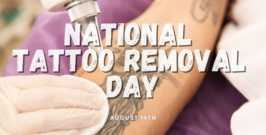 National Tattoo Removal Day in USA in 2025